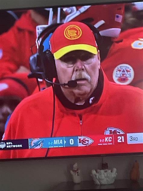 what happened to andy reid's nose